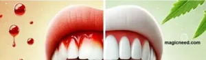 Home-Remedies-for-Gum-Pain-and-Swelling