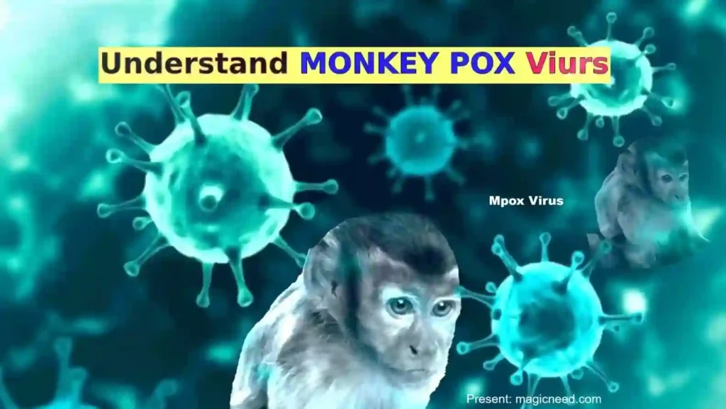 monkeypox