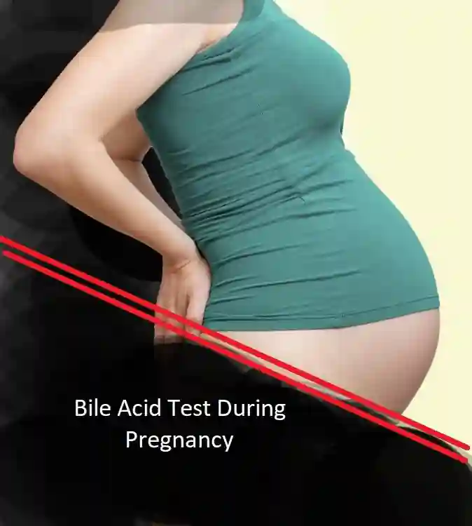 Bile acid test during pregnancy
